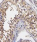 PABPC3 Antibody (N-Term)